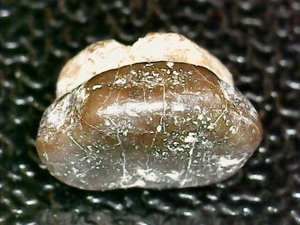 Occlusal view